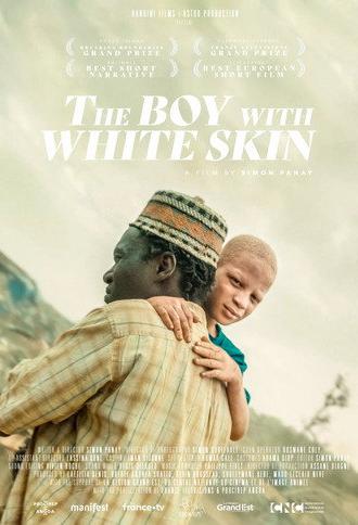 The Boy with White Skin (2024)