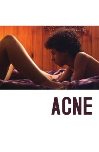 Acne (2008)