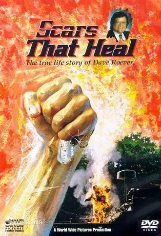 Scars That Heal: The Dave Roever Story (1993)