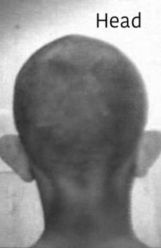 Head (1976)