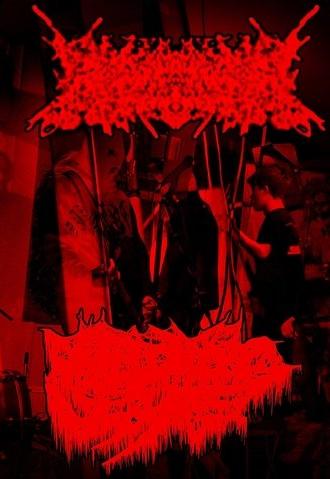 Rhabdomyolysis/Amebiasis Live at The Veil (2023)