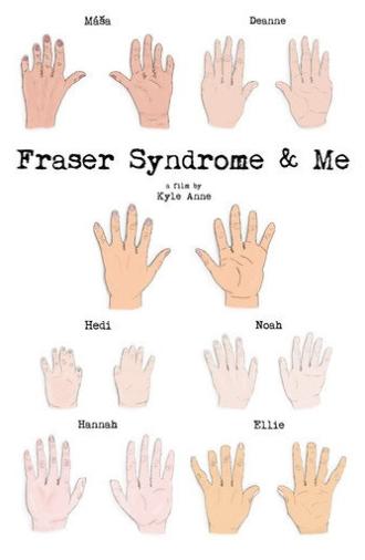 Fraser Syndrome & Me (2018)