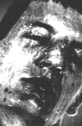 Got Away In the Dying Moments (1992)