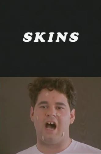 Skins (1997)