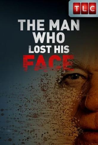 The Man Who Lost His Face (2011)