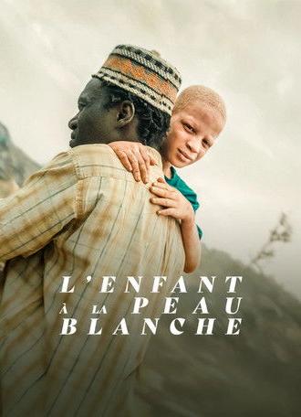 The Boy with White Skin (2024)