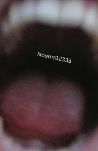 Noema12333 (2025)
