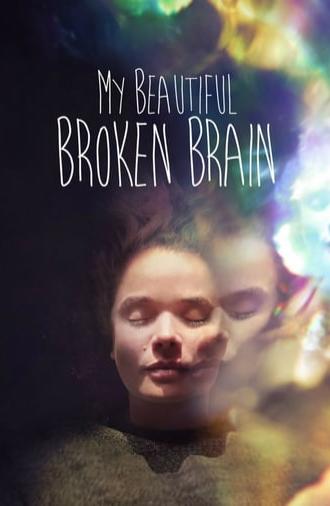 My Beautiful Broken Brain (2014)