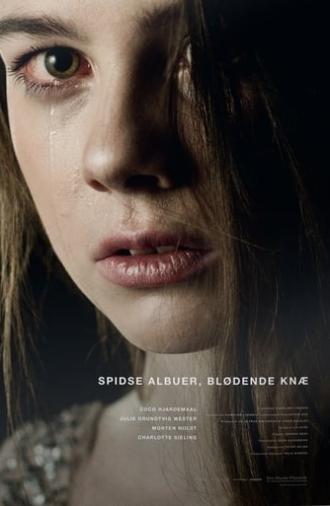 Spidse albuer, blødende knæ (2013)