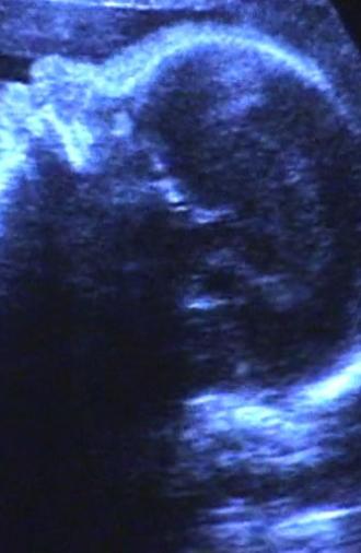 A Short Film for Lida (2003)