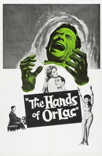 The Hands of Orlac (1960)