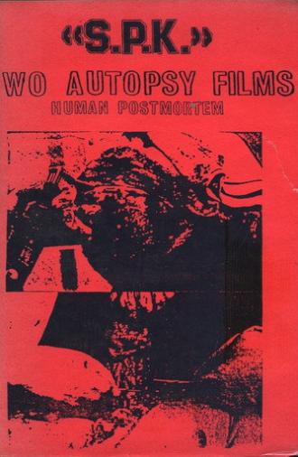 S.P.K.: Two Autopsy Films: Human Postmortem (1983)