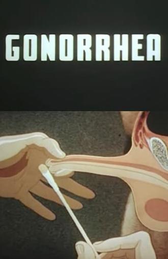 Gonorrhea (1943)