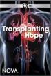 Transplanting Hope (2018)