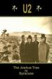 U2: Live from Syracuse 1987 (1987)
